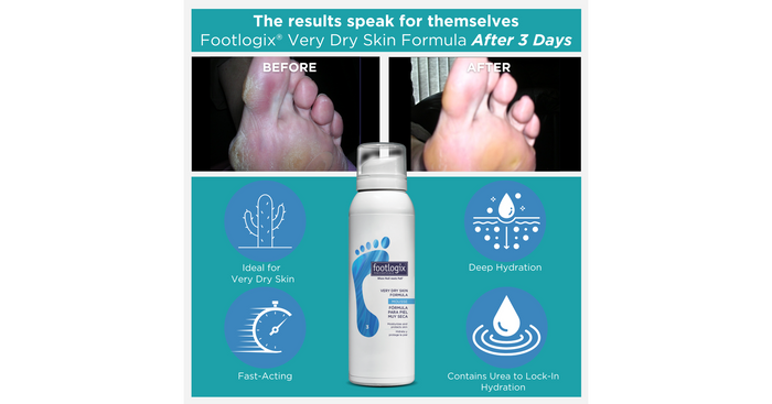 Footlogix Very Dry Skin Formula (125ml/4.23oz./119.9gm)